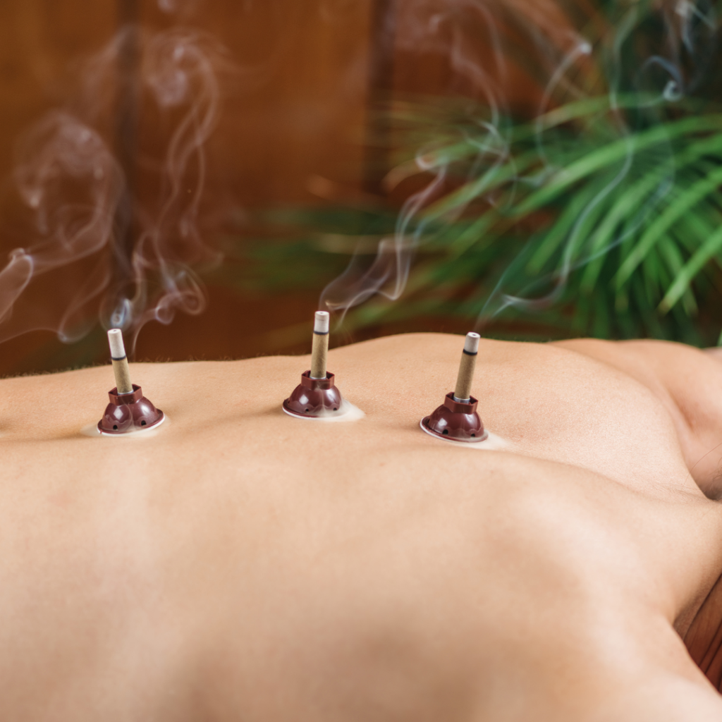 Moxibustion Sun Med Acupuncture Noosa Sunshine Coast